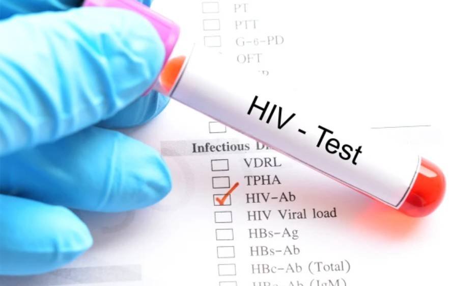 HIV